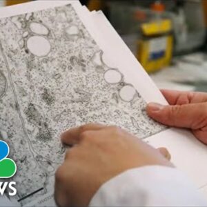 CDC Issues Alert About Virus That Can Cause Respiratory Illness Among Kids
