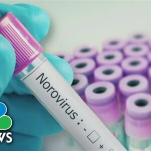 Norovirus cases spike in both kids and adults